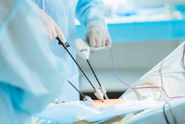 Laparoscopic Surgery